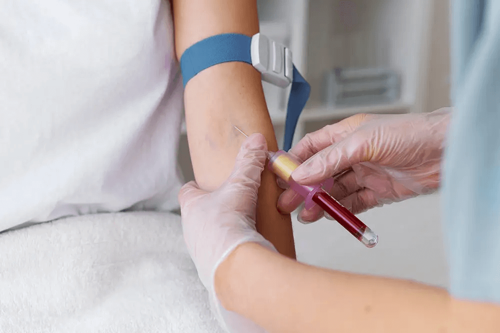 Healthcare professional collecting blood sample from patient's arm with tourniquet