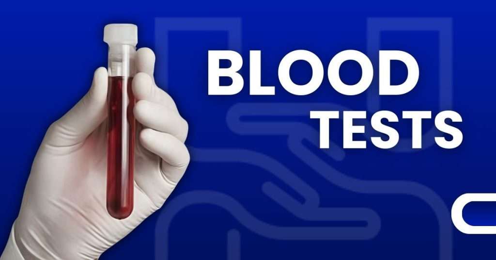 Healthcare professional holding blood test tube on blue background