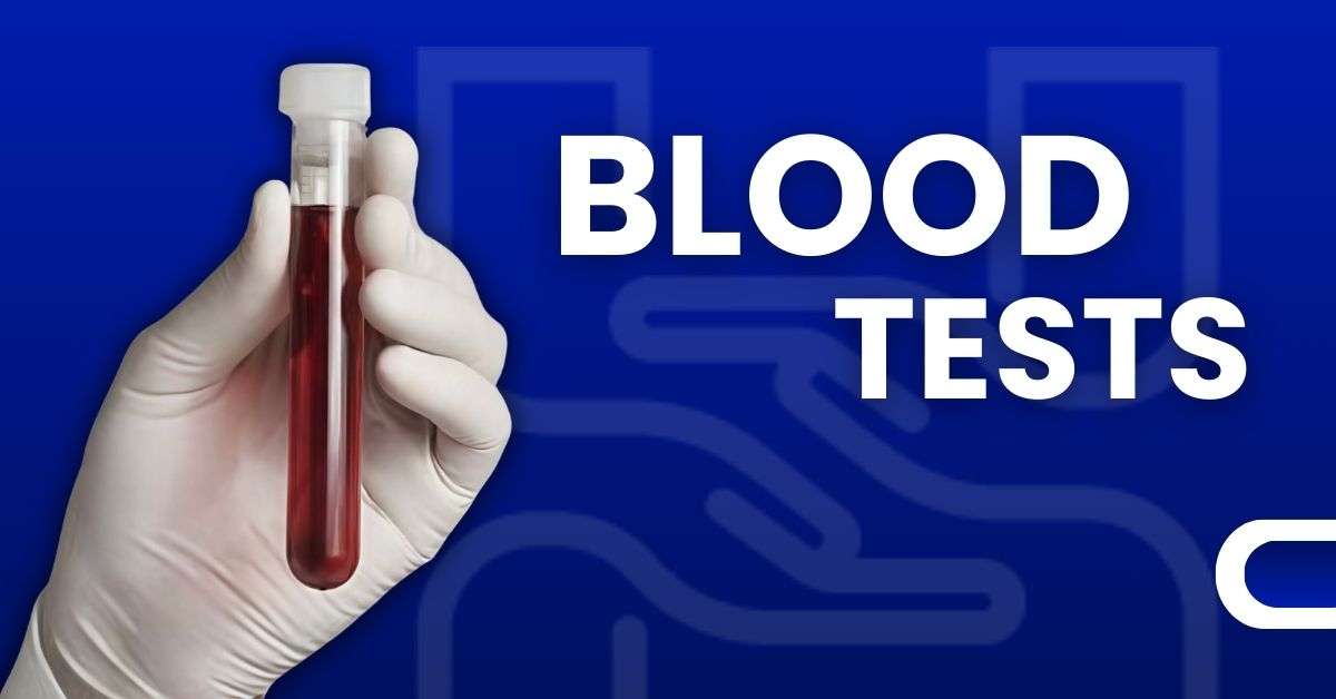 Healthcare professional holding blood test tube on blue background